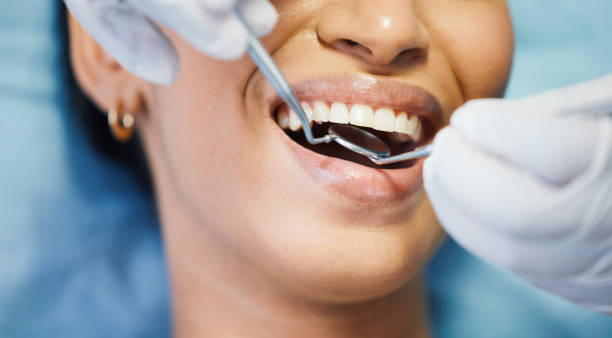 Best Emergency Treatment for Toothache in Choccolocco, AL